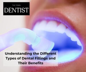 dental-fillings