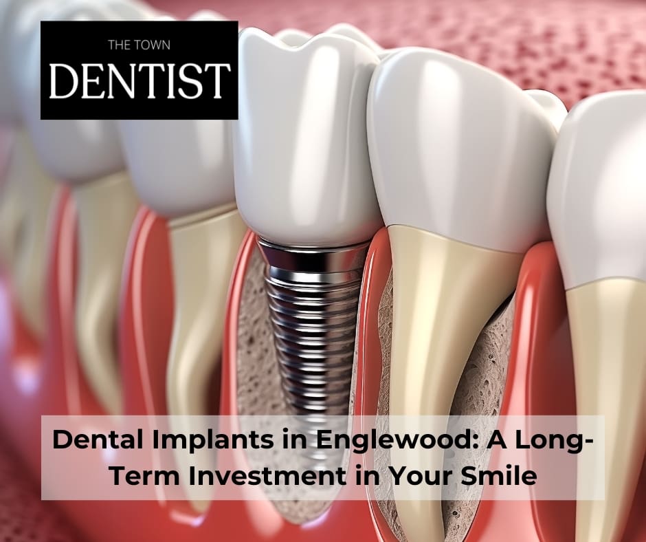 Dental Implants