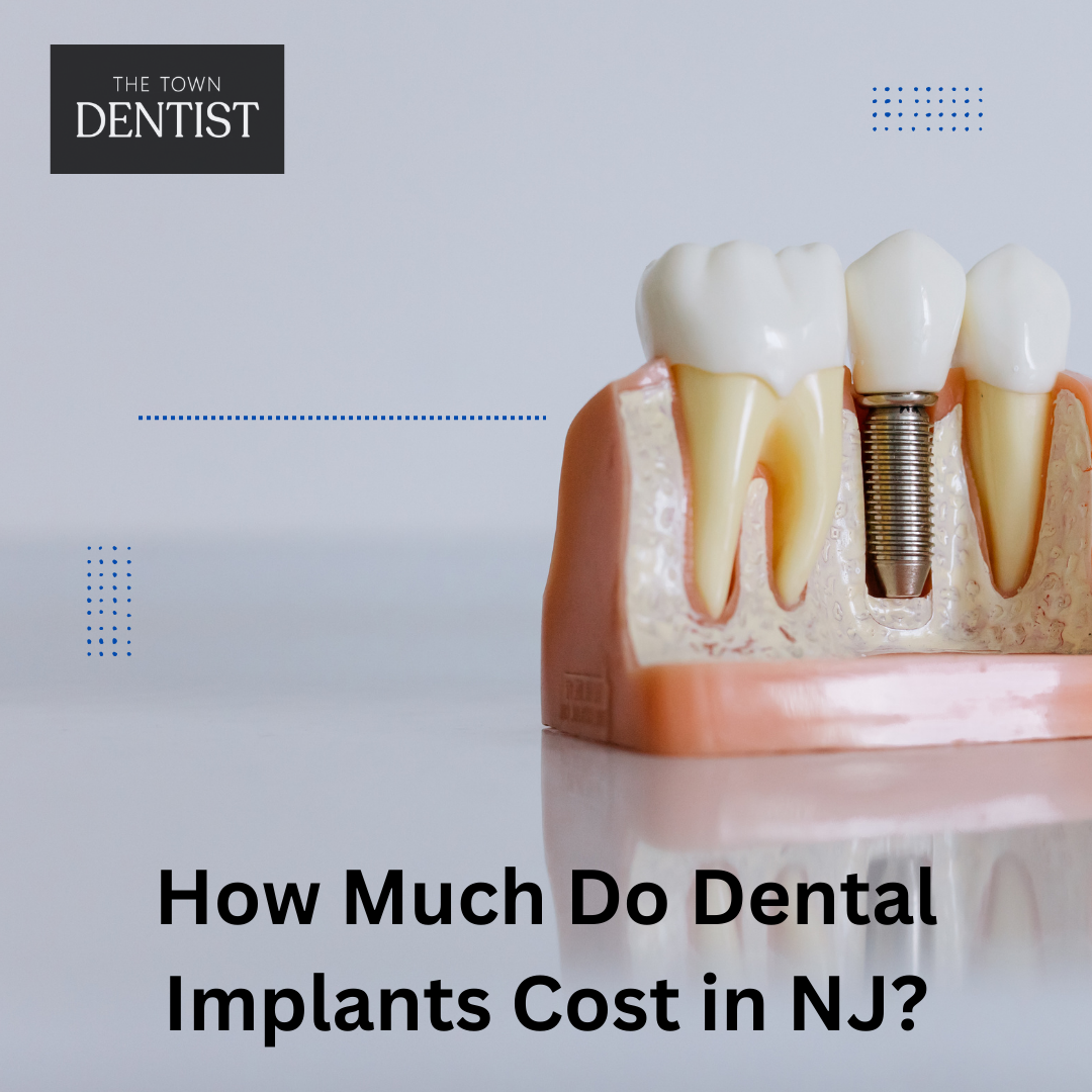 How Much Do Dental Implants Cost in NJ?