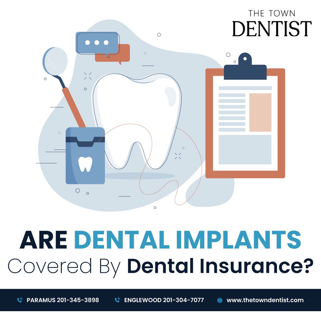Are Dental Implants Covered By Dental Insurance