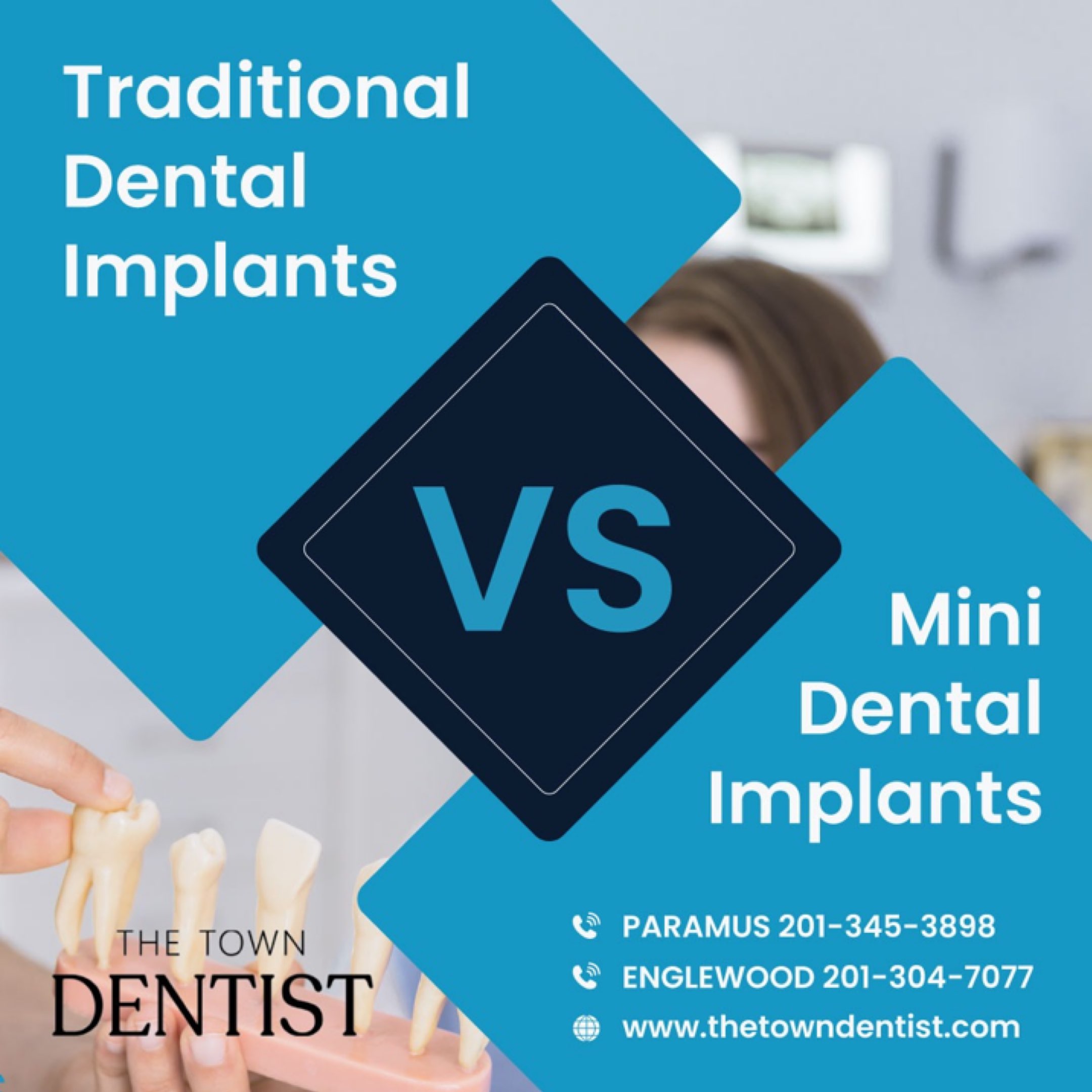 Traditional Dental Implants Vs Mini Dental Implants