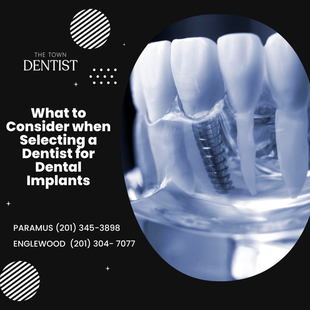 What to Consider when Selecting a Dentist for Dental Implants