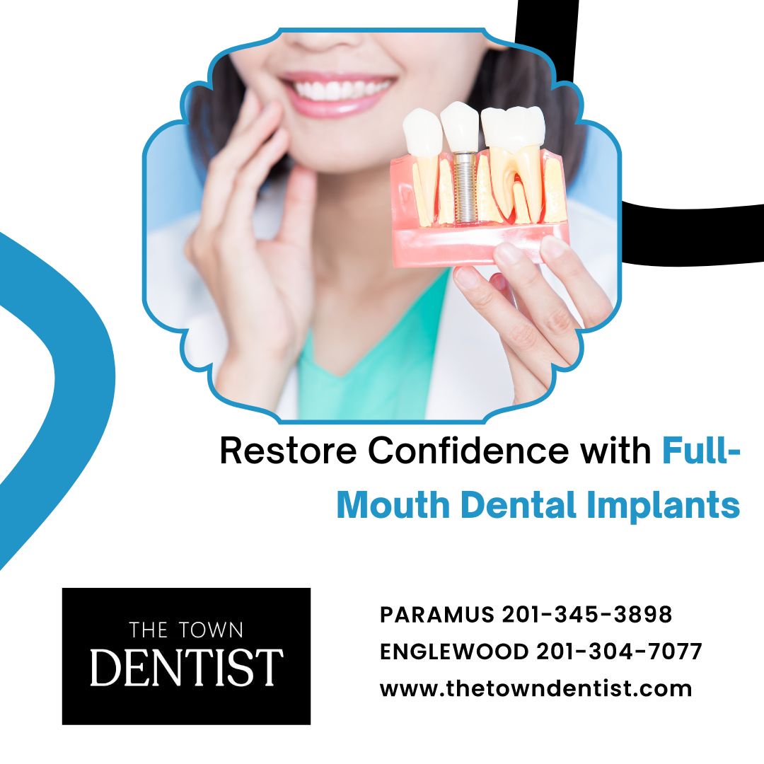 Full-Mouth Dental Implants