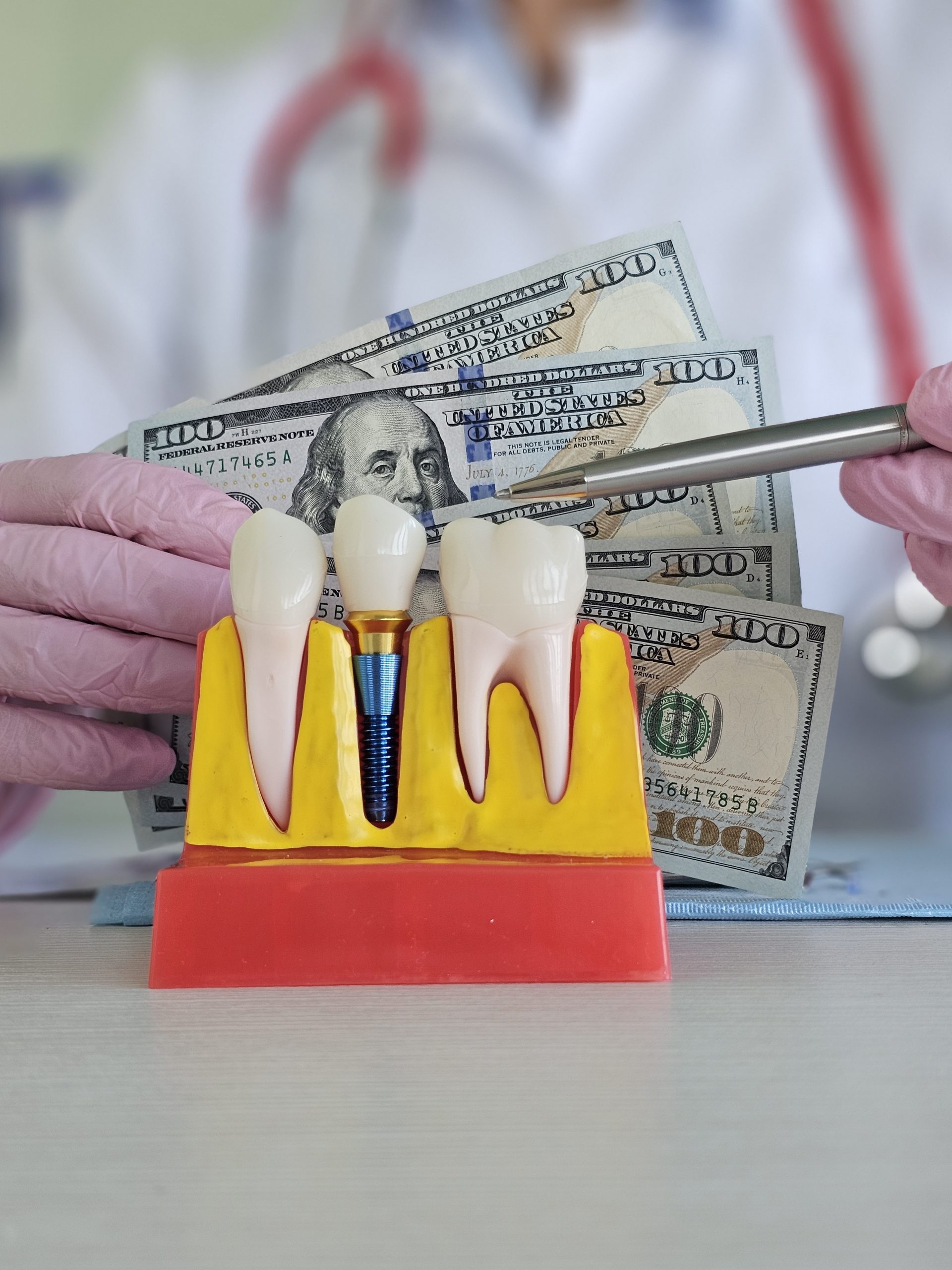 Cost of Dental Implants