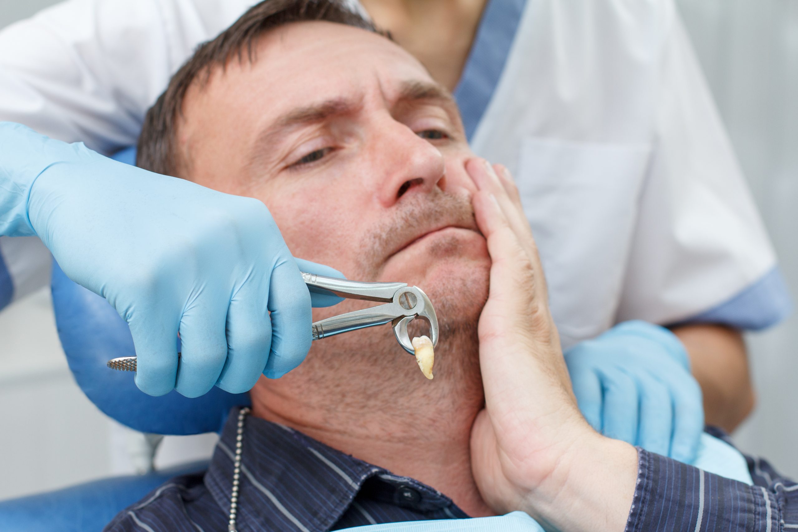 wisdom tooth extraction
