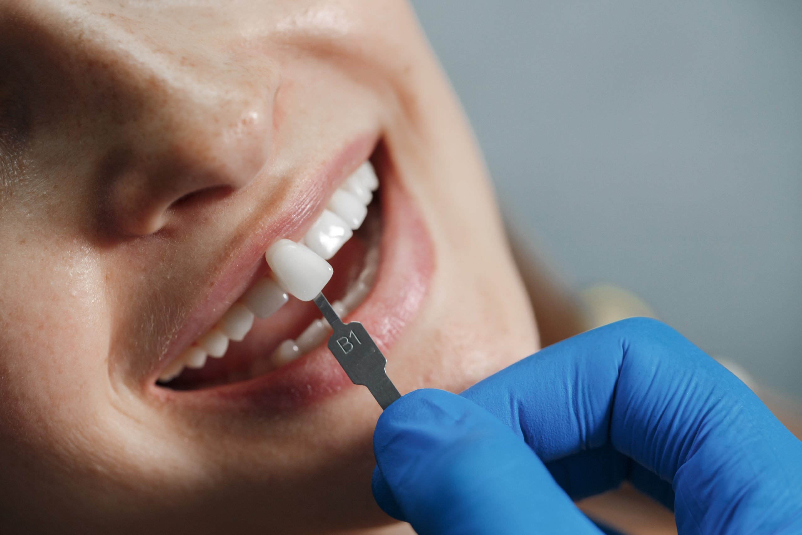 tooth implant