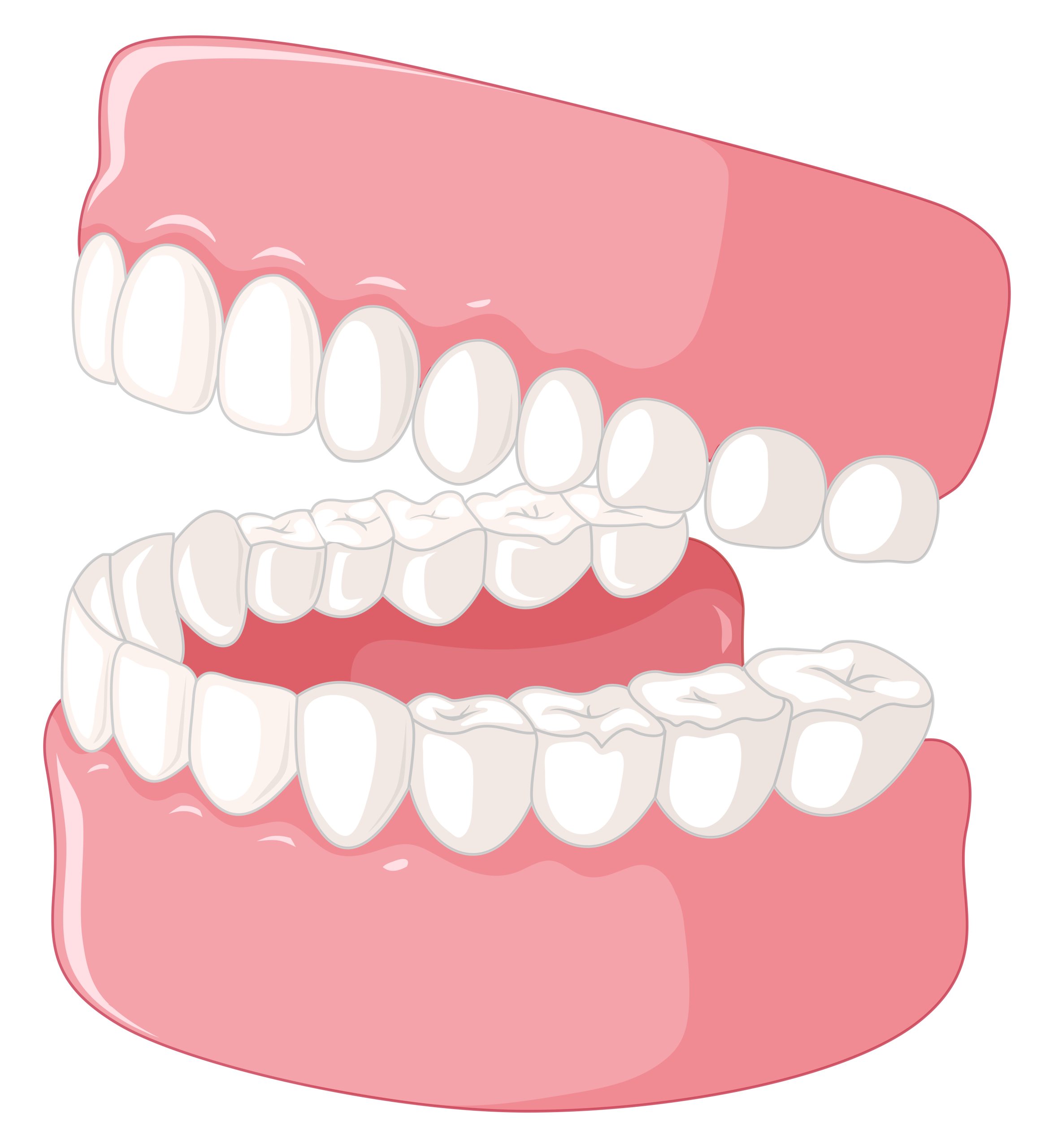 Full Mouth Dental