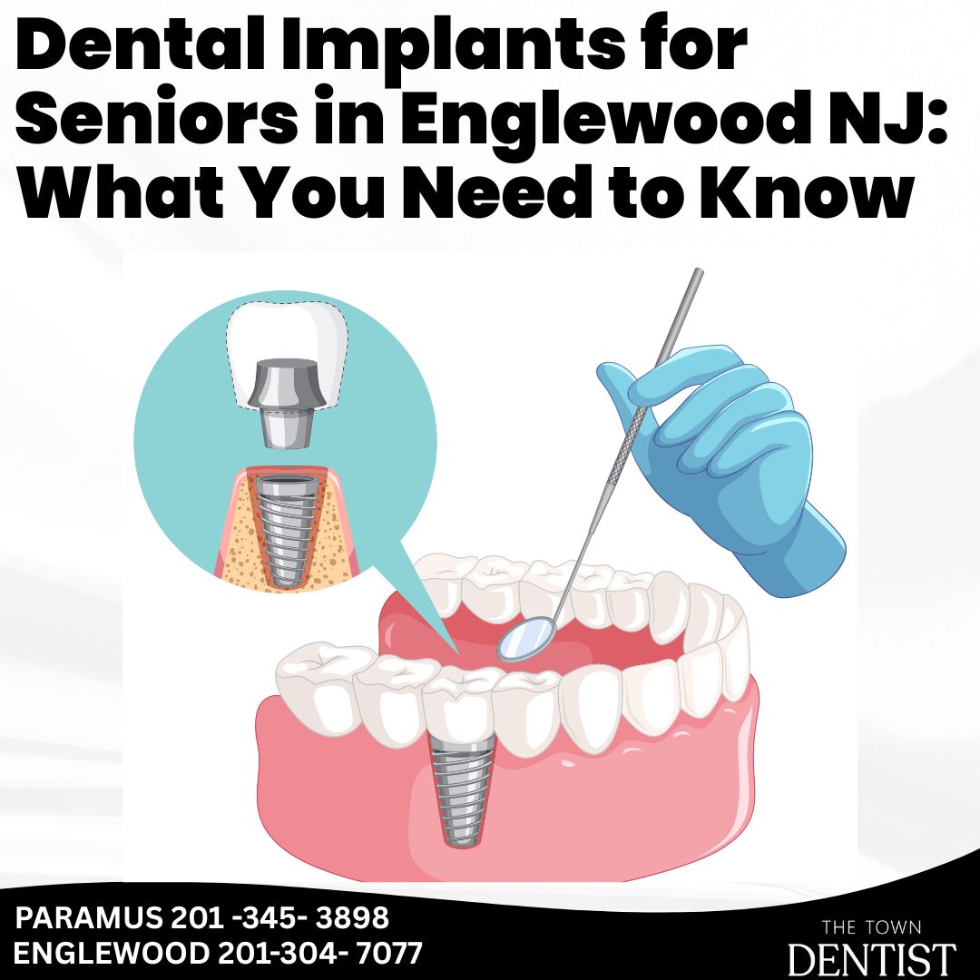 Dental Implants for Seniors in Englewood NJ What You Need to Know