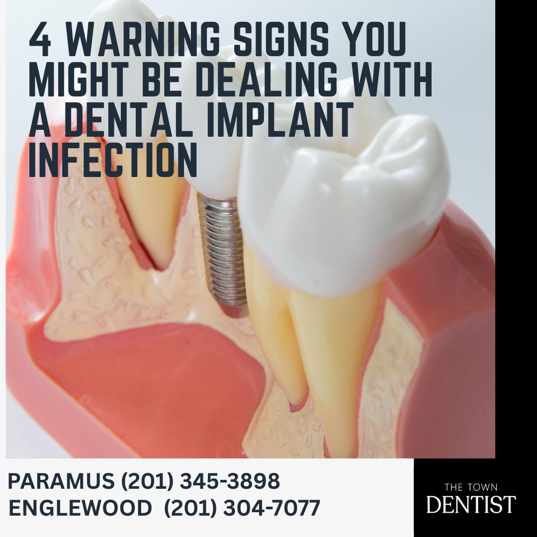4 Warning Signs You Might Be Dealing with a Dental Implant Infection