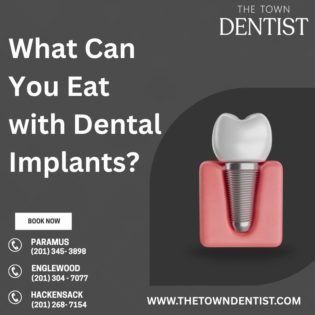 What Can You Eat with Dental Implants
